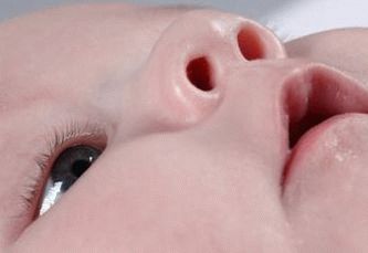 كيفية غرس قطرات في الطفل
