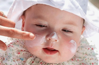 îngrijirea pielii nou-născuților