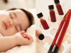 كيف يأخذ الطفل الدم من الوريد