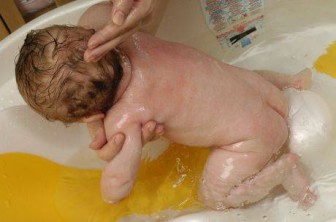 Na elke ontlasting is het noodzakelijk om de baby te wassen, zijn huid te drogen en de plooien te behandelen met talkpoeder of babycrème.