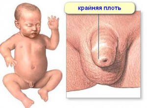 Intimhygiene von Neugeborenen