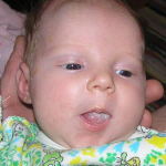 Foto von Soor bei Neugeborenen in der Zunge