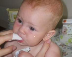 léčit drozd v ústech novorozence