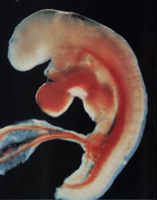 Photo of the embryo in the 4th week