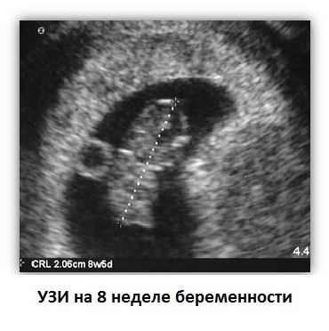 Uzi-at-8 hetes terhesség