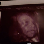 29 săptămâni foto-ultrasunete