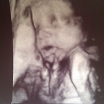 foto-ultrazvuk-27 týdnů