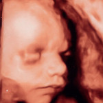ultrazvuk-29-týden-foto