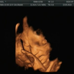 ultrasound-31-minggu
