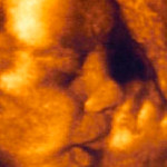 ultrazvuk-dítě-saje-prst