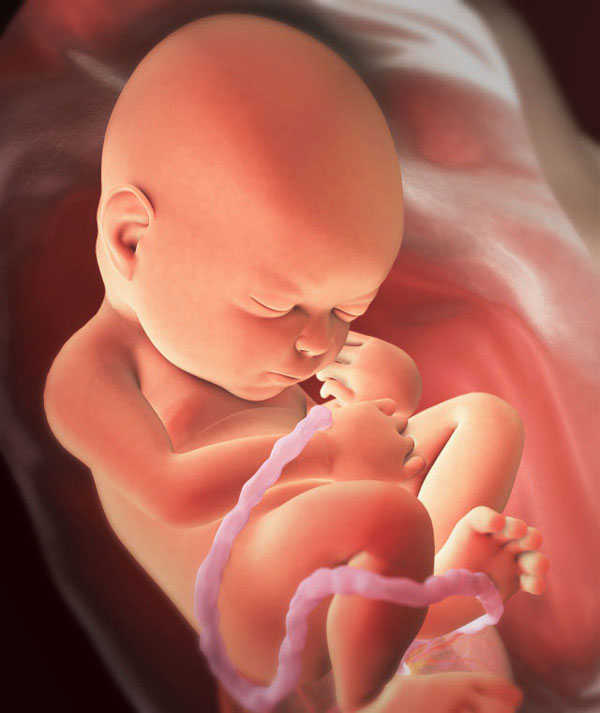 36-week-old fetus