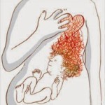 pálení žáhy u těhotných žen