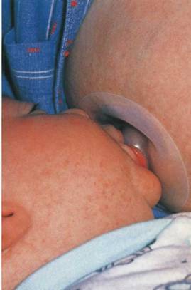 bayi menghisap payudara dengan lapisan