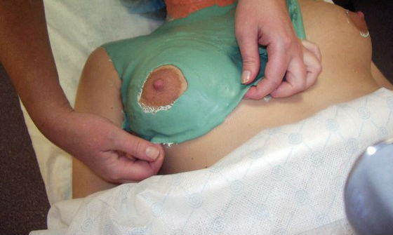 masks for breast lifting