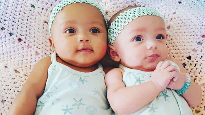 anak kembar
