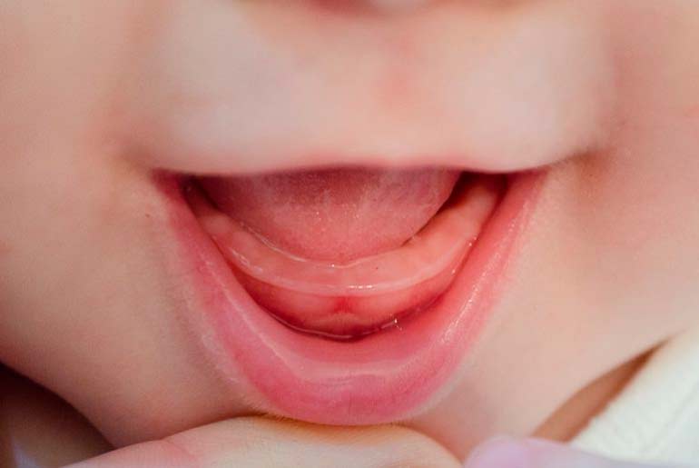 zuby dítěte jsou řezány